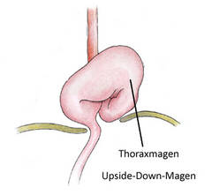 Thoraxmagen